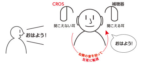 CROSとは