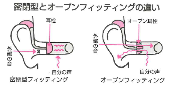 補聴器装用の場合：２つのメインのフィッティング方法を説明する画像