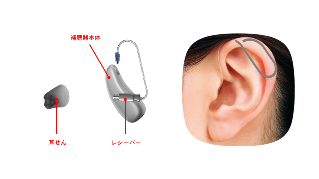 RIC型補聴器の構造と装用した時の見た目