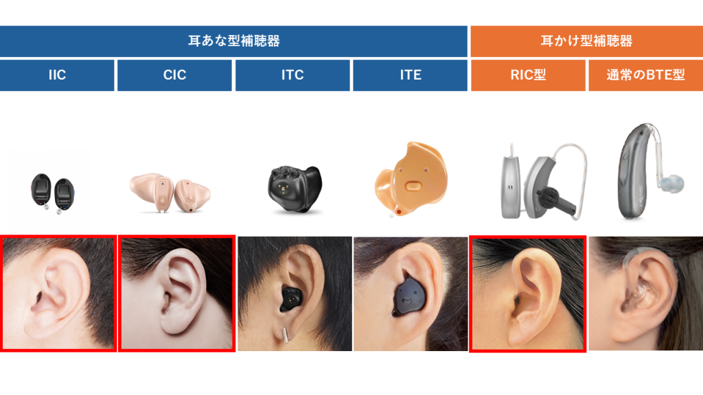 補聴器の種類と装用したときの見た目