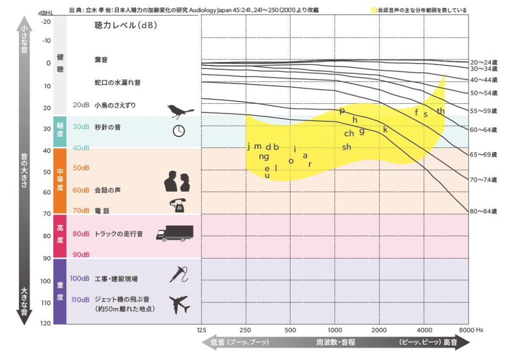 聴力図