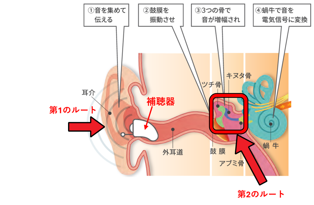 補聴器を装用する場合の音の聞こえ方の図です