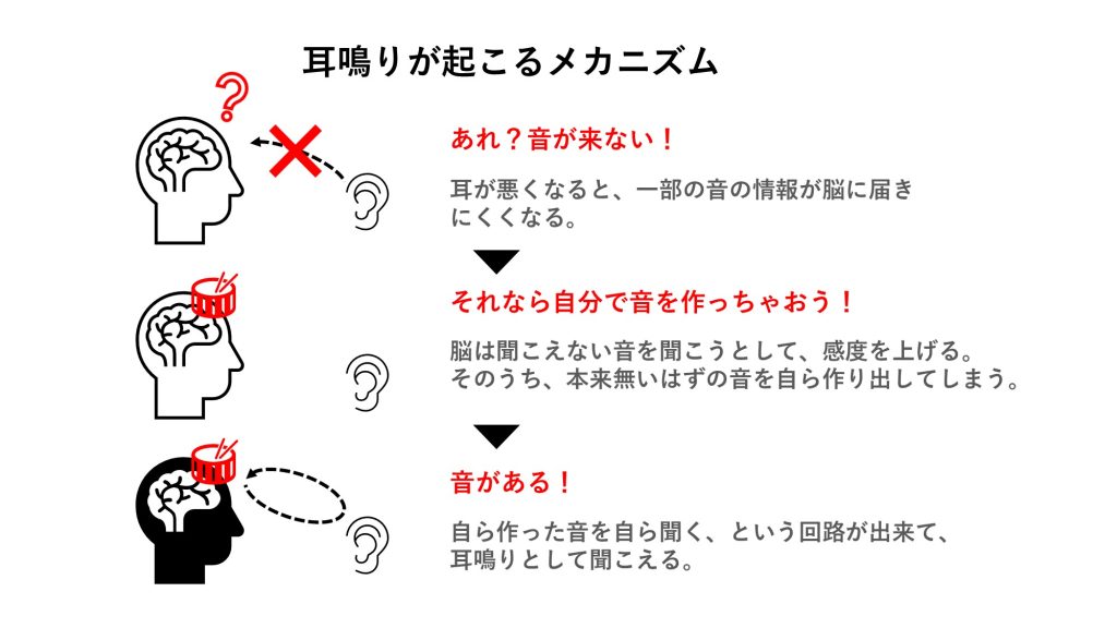 耳鳴り発生の仕組み
